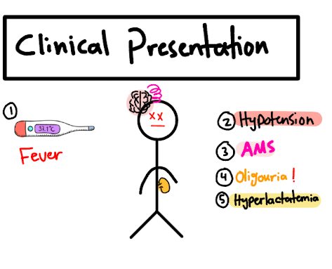 Clinical presentation diagram: Fever, Hypertension, AMS, Oligemia, Hyperlactatemia in a numbered list