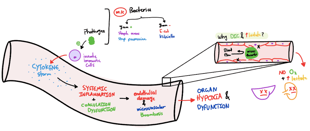 sepsis and septic shock pathophysiology